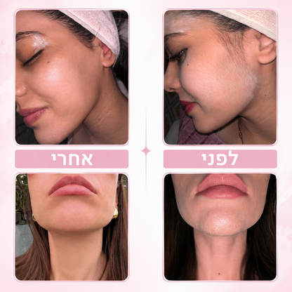 מסיר השיער של ולארו